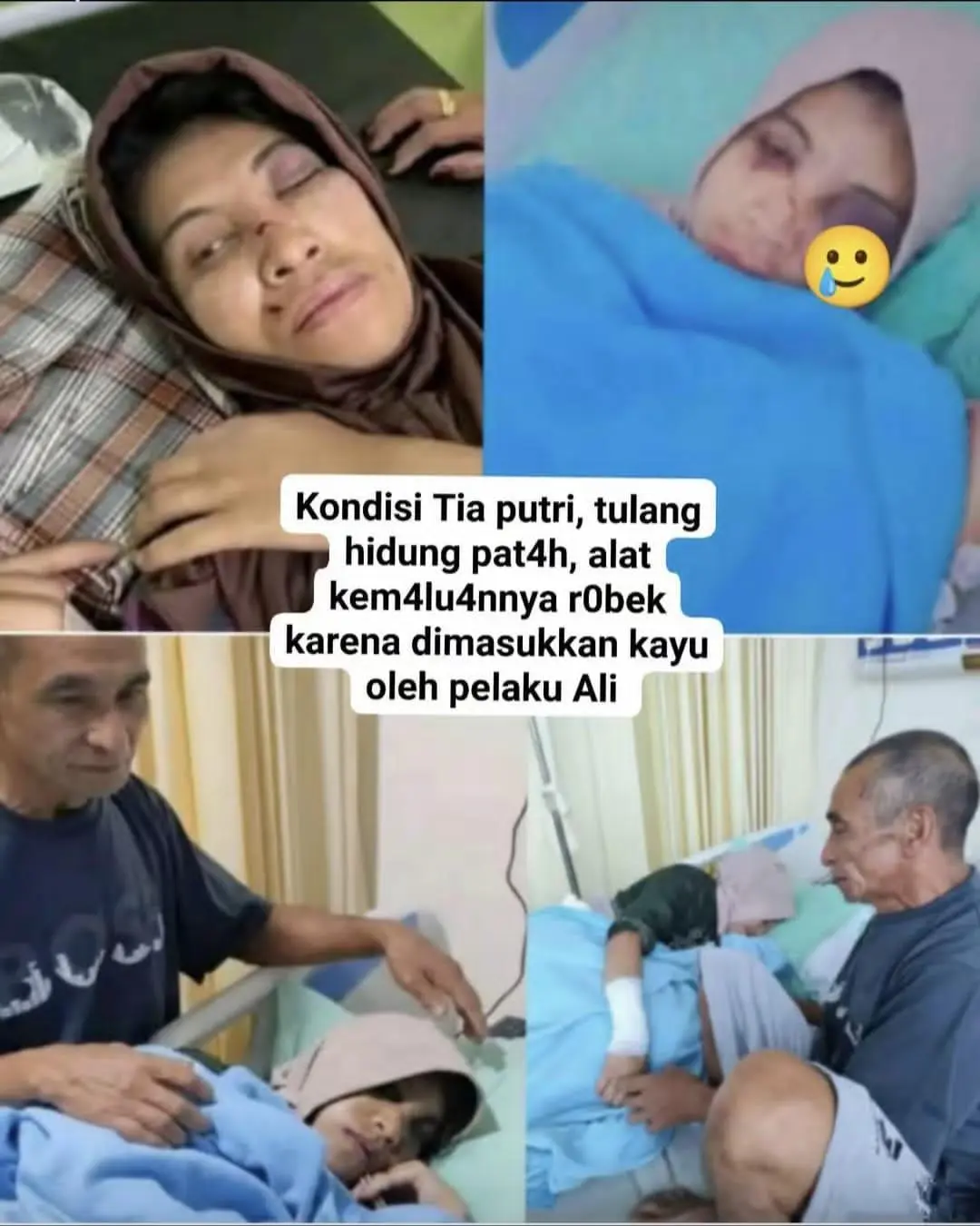 Gadis Disabilitas Jadi Korban Kekerasan, Satu Terduga Pelaku Tewas Diamuk Massa di Gowa