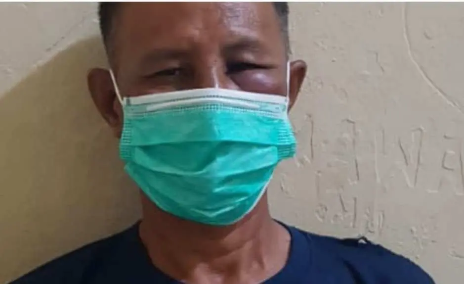 Tersinggung Tak diberi Tahu Acara Aqeqah Cucunya, Jamaan Ngamuk Tebas Punggung Suami Mantan Istrinya